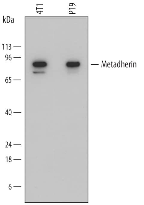 Detection of Mouse Metadherin antibody by Western Blot.