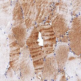 Meteorin-like/METRNL antibody in Human Skeletal Muscle by Immunohistochemistry (IHC-P).