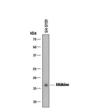 Detection of Human Midkine antibody by Western Blot.