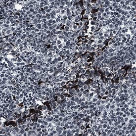 Midkine antibody in Human Seminoma (testicle tumor) by Immunohistochemistry (IHC-P).
