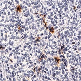 Midkine antibody in Human Liver Cancer Tissue by Immunohistochemistry (IHC-P).