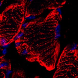 Mitofusin 2 antibody in Mouse Skeletal Muscle by Immunohistochemistry (IHC-Fr).