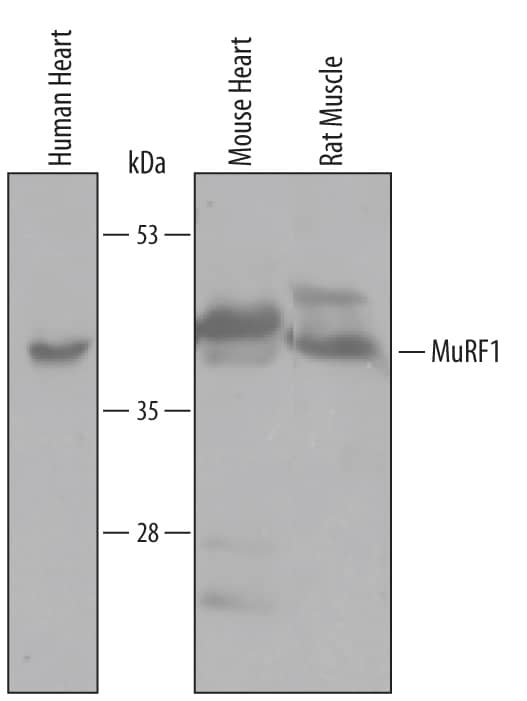 Detection of Human/Mouse/Rat MuRF1 antibody by Western Blot.