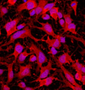 Musashi-2 antibody in Rat Cortical Stem Cells by Immunocytochemistry (ICC).