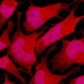Musashi-1 antibody in Rat Cortical Stem Cells by Immunocytochemistry (ICC).