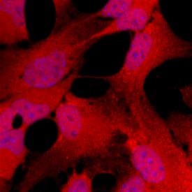 Musashi-1 antibody in Mouse Cortical Stem Cells by Immunocytochemistry (ICC).