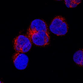 Musashi-2 antibody in MOLT-4 Human Cell Line by Immunocytochemistry (ICC).