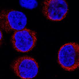 Musashi-2 antibody in K562 Human Cell Line by Immunocytochemistry (ICC).