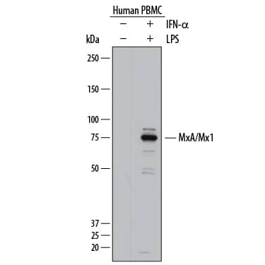 Detection of Human MxA/Mx1 antibody by Western Blot.