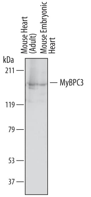 Detection of Mouse MyBPC3 antibody by Western Blot.