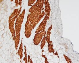 MyBPC3 antibody in Human Heart by Immunohistochemistry (IHC-P).