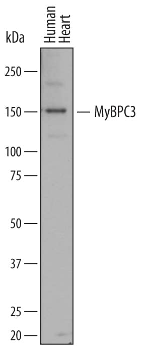 Detection of Human MyBPC3 antibody by Western Blot.