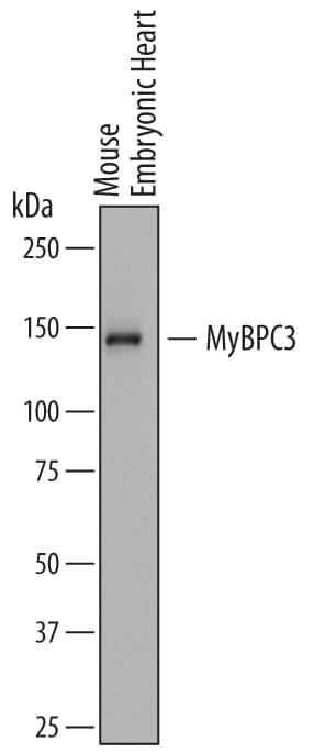 Detection of Mouse MyBPC3 antibody by Western Blot.