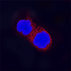 MyD88 antibody in Raji Human Cell Line by Immunocytochemistry (ICC).