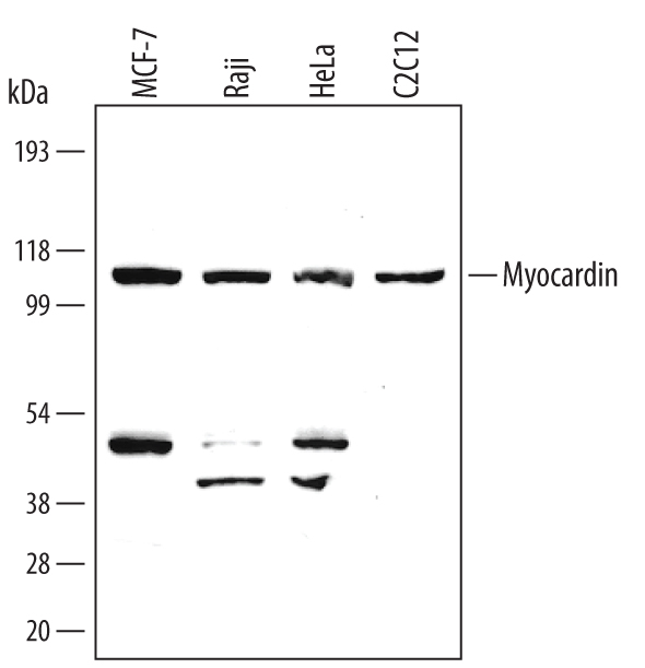 Detection of Human Myocardin antibody by Western Blot.