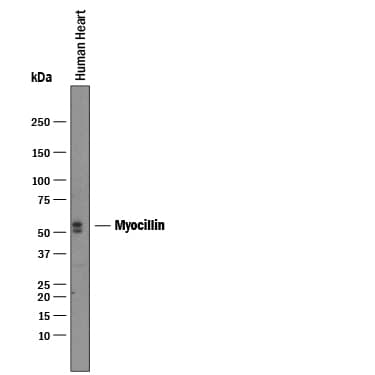 Detection of Human Myocilin antibody by Western Blot.