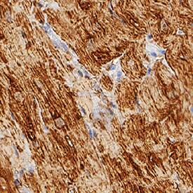 Myoglobin antibody in Human Heart by Immunohistochemistry (IHC-P).