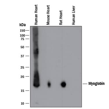 Detection of Human, Mouse, and Rat Myoglobin antibody by Western Blot.