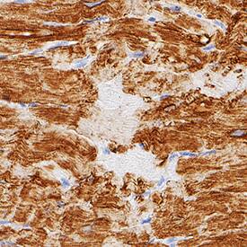 Myoglobin antibody in Human Heart by Immunohistochemistry (IHC-P).