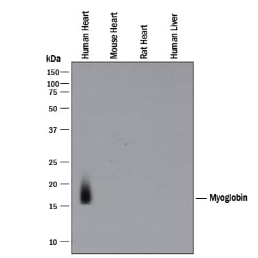 Detection of Human Myoglobin antibody by Western Blot.