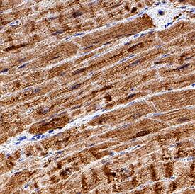 Myoglobin antibody in Human Heart by Immunohistochemistry (IHC-P).