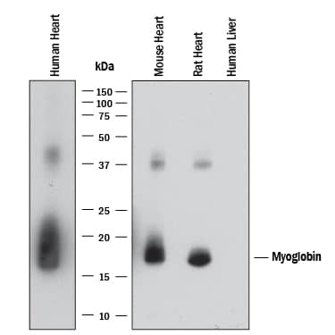 Detection of Human, Mouse, and Rat Myoglobin antibody by Western Blot.