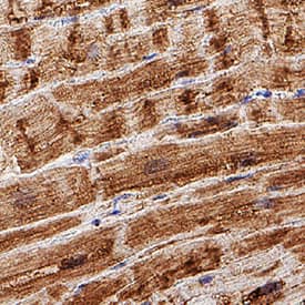 Myoglobin antibody in Human Heart by Immunohistochemistry (IHC-P).