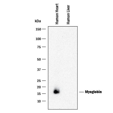 Detection of Human Myoglobin antibody by Western Blot.