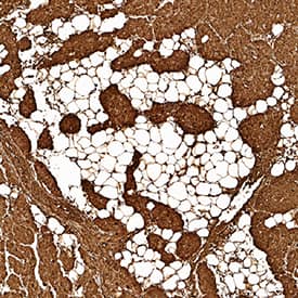 Myoglobin antibody in Human Heart by Immunohistochemistry (IHC-P).