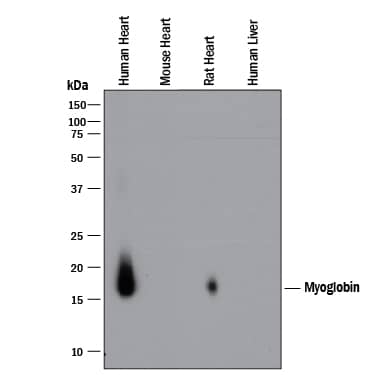 Detection of Human and Rat Myoglobin antibody by Western Blot.