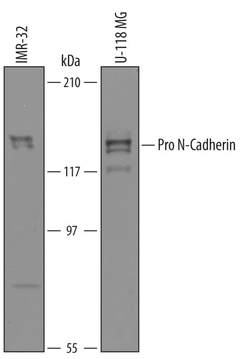 Detection of Human Pro-N-Cadherin antibody by Western Blot.