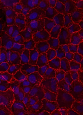 N-Cadherin antibody in A549 Human Cell Line by Immunocytochemistry (ICC).