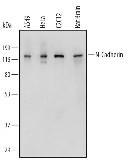 Detection of Human, Mouse, and Rat N-Cadherin antibody by Western Blot.