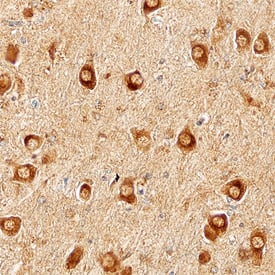 N-Cadherin antibody in Human Brain by Immunohistochemistry (IHC-P).