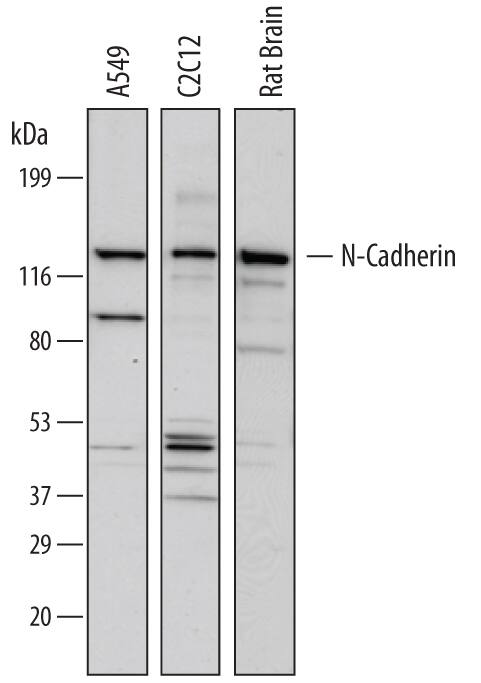 Detection of Human, Mouse, and Rat N-Cadherin antibody by Western Blot.