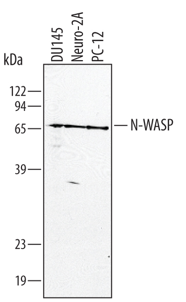 Detection of Human, Mouse, and Rat N-WASP antibody by Western Blot.