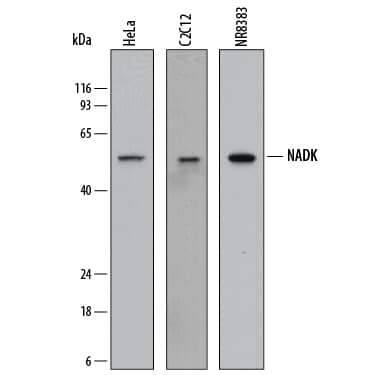 Detection of Human, Mouse, and Rat NADK antibody by Western Blot.