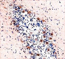 NAIP antibody in Human Brain by Immunohistochemistry (IHC-P).