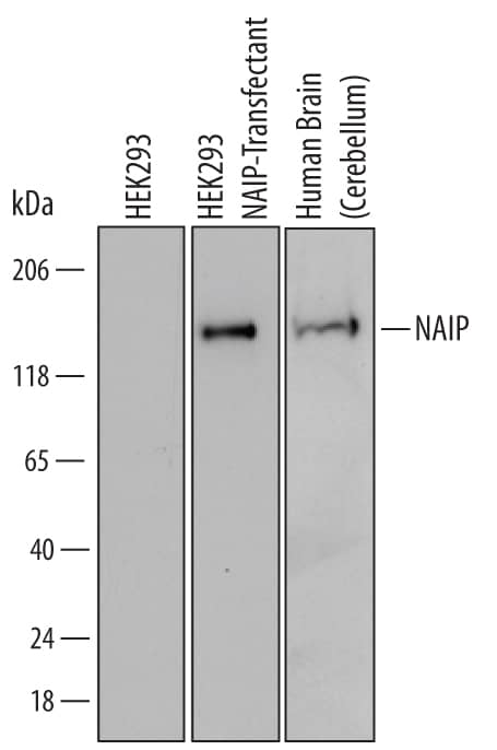 Detection of Human NAIP antibody by Western Blot.