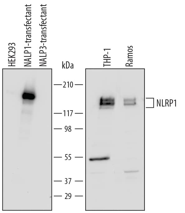 Detection of Human NLRP1/NALP1 antibody by Western Blot.