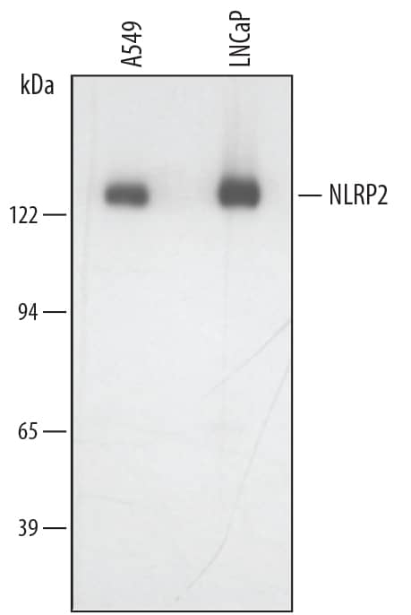 Detection of Human NLRP2/NALP2 antibody by Western Blot.