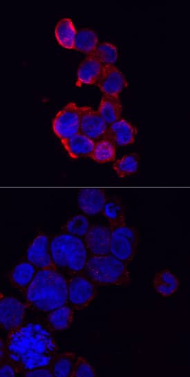 NLRP3/NALP3 antibody in THP-1 Human Cell Line by Immunocytochemistry (ICC).