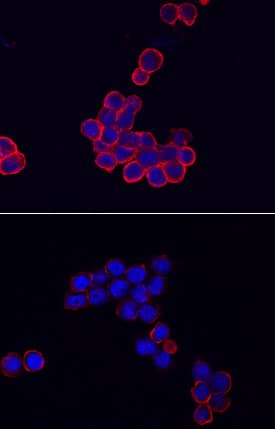 NLRP3/NALP3 antibody in THP-1 Human Cell Line by Immunocytochemistry (ICC).