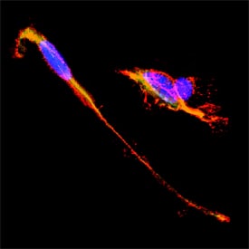 NCAM-1/CD56 antibody in SH-SY5Y Human Neuroblastoma Cells by Immunocytochemistry (ICC).