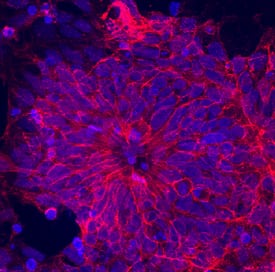 NCAM-1/CD56 antibody in BG01V Human Embryonic Stem Cells by Immunocytochemistry (ICC).
