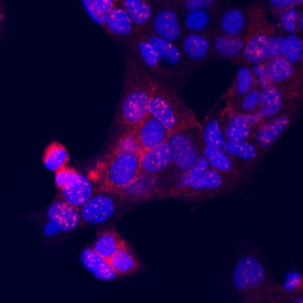 NCK1 antibody in MCF-7 Human Cell Line by Immunocytochemistry (ICC).