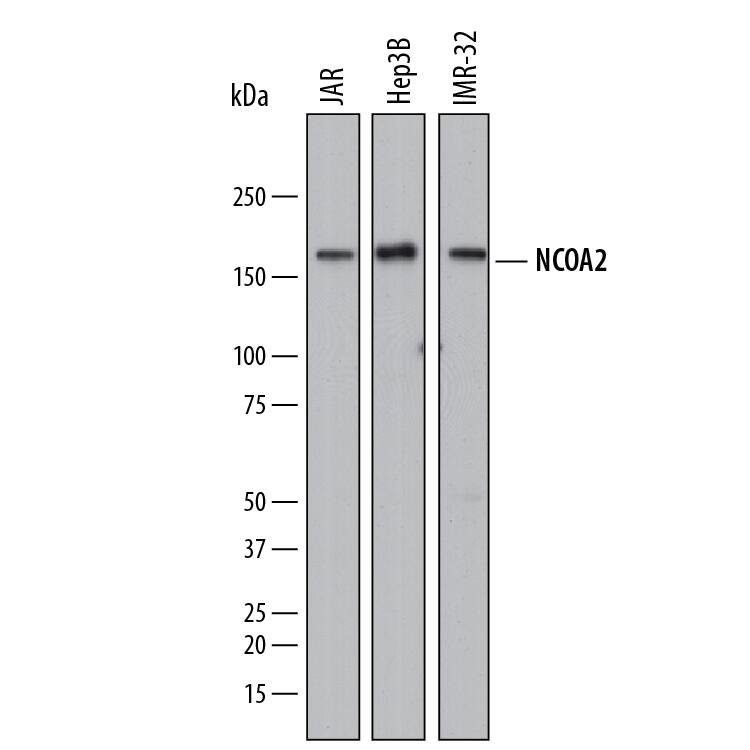 Detection of Human NCOA2 antibody by Western Blot.