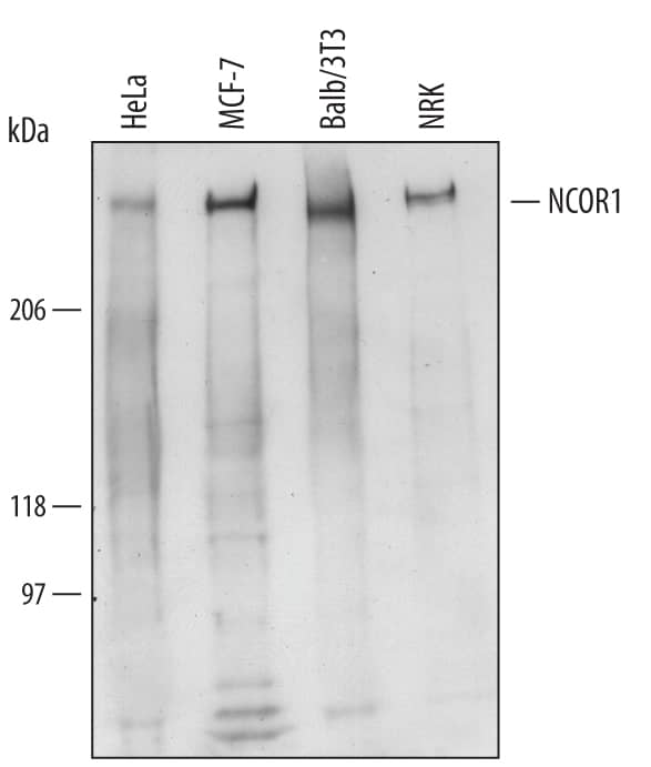 Detection of Human, Mouse, and Rat NCOR1 antibody by Western Blot.