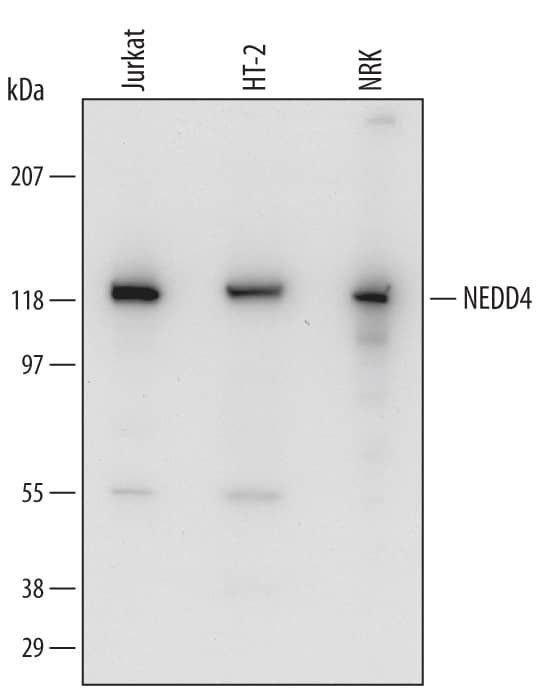 Detection of Human, Mouse, and Rat NEDD4 antibody by Western Blot.