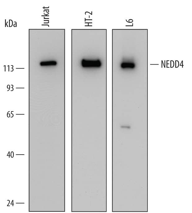 Detection of Human, Mouse, and Rat NEDD4 antibody by Western Blot.